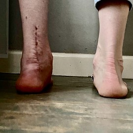Angepasste Weichteilarbeit in Rehabilitationsübungen