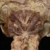 Verbesserung klinischer Palpationstechniken mit Bildern der Leichenanatomie