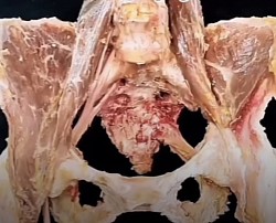 Klinisches Palpationstraining bei Leistenschmerzen