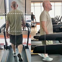 Die Videoanalyse des Laufbands informiert und vermittelt das Verständnis für Ausrichtungsprobleme