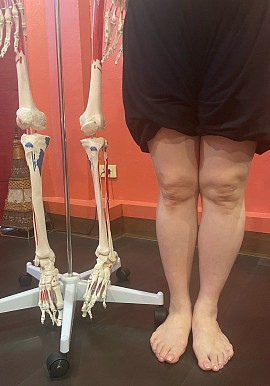 Praktischer Unterricht: Kontakt und Belastung am vorderen Knie anpassen