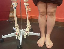 Ursachen von Knieschmerzen anhand der Gelenkstruktur verstehen