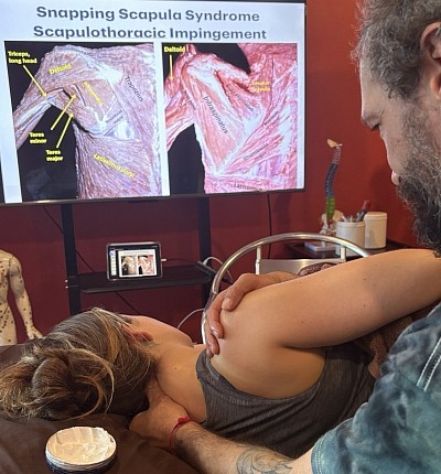 Triggerpunkttherapie und Sportmedizin