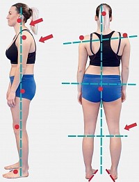 Posture d'évitement de la douleur