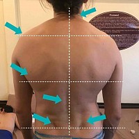 L'évaluation de la posture et la palpation déterminent la direction du massage postural