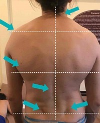 Penilaian postur tubuh dengan palpasi