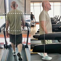 Treadmill video analysis informs and communicates the understanding of alignment issues