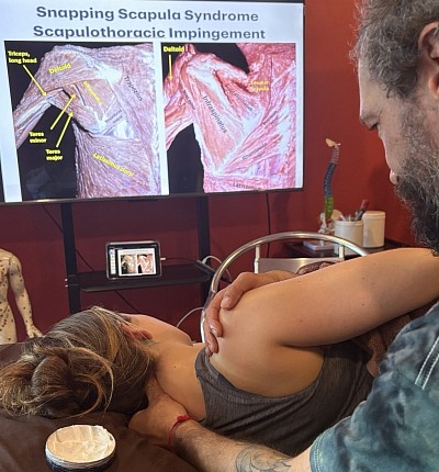 Trigger Point therapy and Sports Medicine