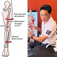Kinetic Chain Assessment