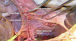 Fotografie anatomiche di cadaveri per l'apprendimento visivo