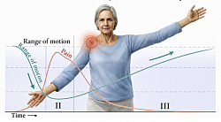 Tecniche avanzate di mobilizzazione articolare e loro applicazione clinica