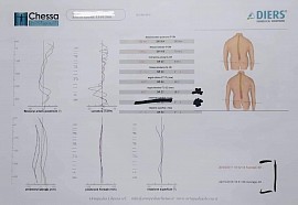 Dynamiek van de kernkinetische keten - ons medisch bewijs