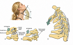 Biomecânica da coluna vertebral inclinada