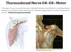 Material anatômico do latíssimo do dorso e do nervo toracodorsal, com esquema e foto de dissecação